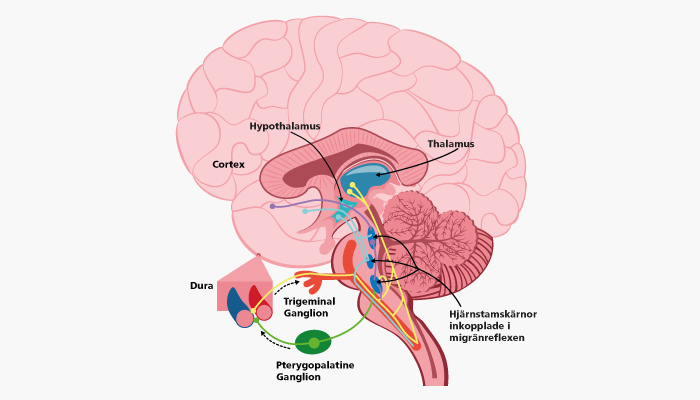 Illustration Migrän hjärna 